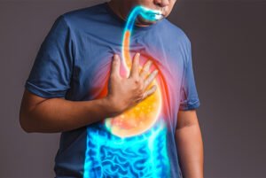 Esophagus Surgeon in Ahmedabad