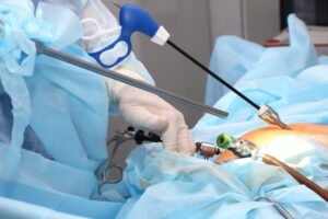 Laparoscopic Surgeon In Ahmedabad