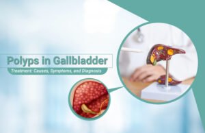 Polyps in Gallbladder Treatment
