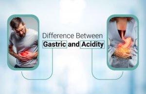 Difference Between Gastric and Acidity