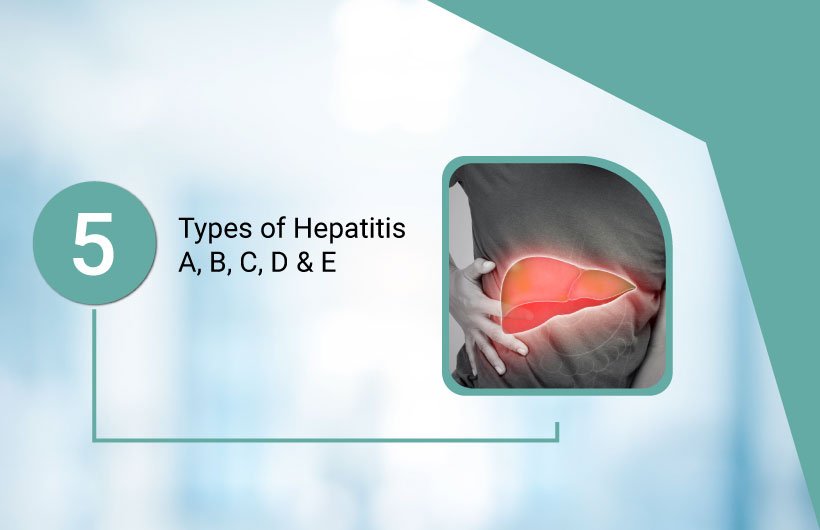 Types of Hepatitis A, B, C, D, E