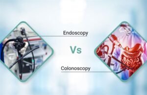 Endoscopy vs Colonoscopy