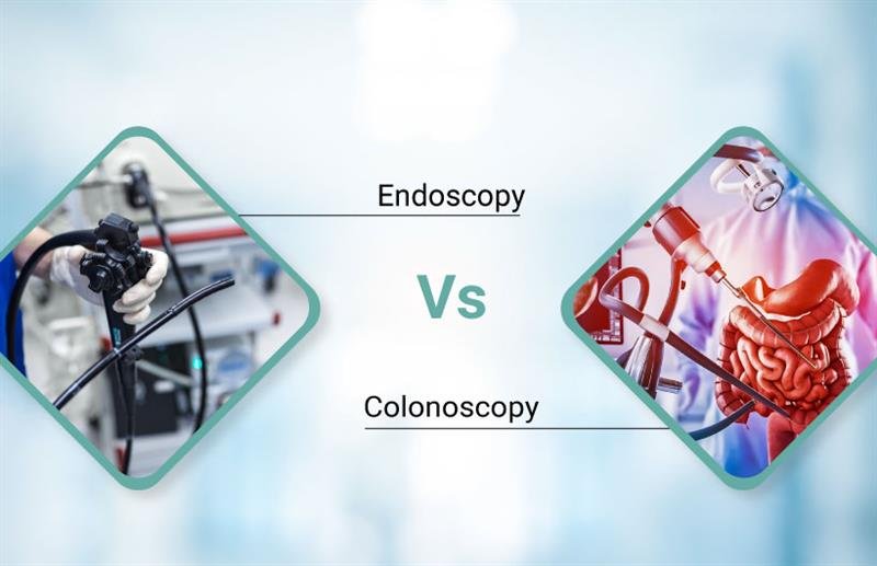 Endoscopy vs Colonoscopy
