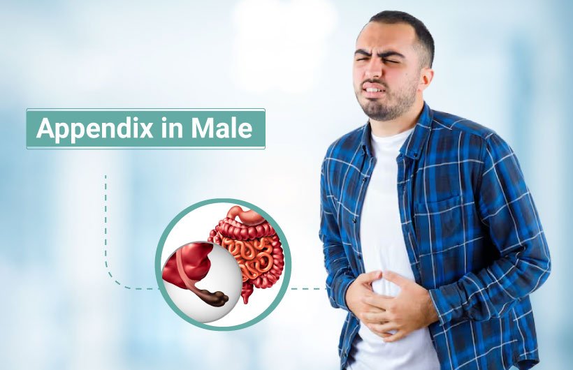 Appendix in Male