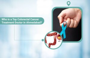 Top Colorectal Cancer Treatment Doctor in Ahmedabad