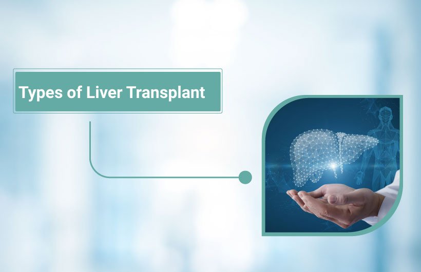 Types of liver transplant