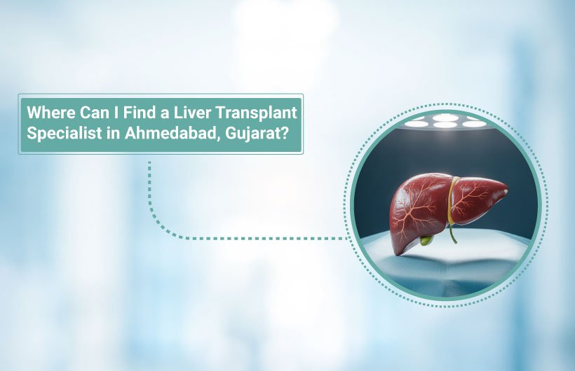 Where to find liver Specialist in Ahmedabad