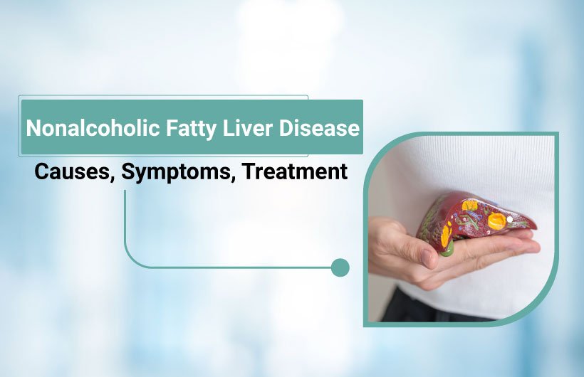 Nonalcoholic Fatty Liver Disease