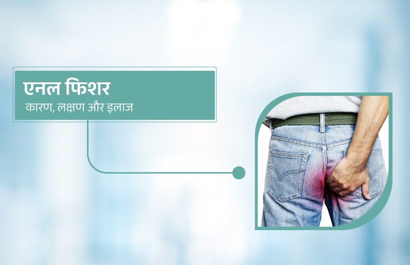 Anal Fissure in Hindi