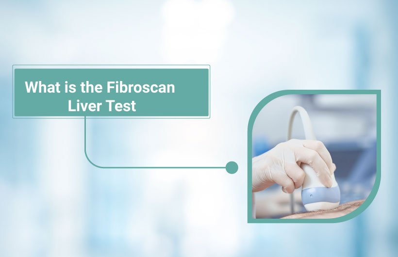 Fibroscan Liver Test