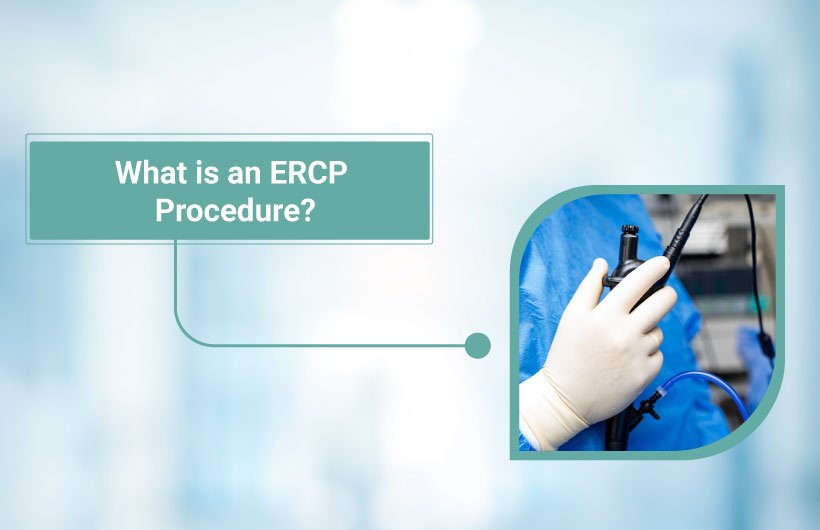 What is an ERCP Procedure? Everything You Need to Know