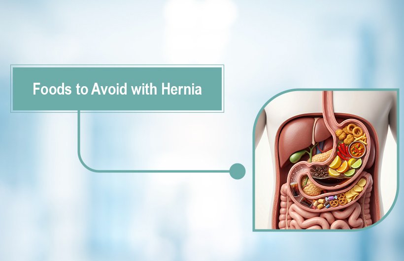 Foods to Avoid with Hernia