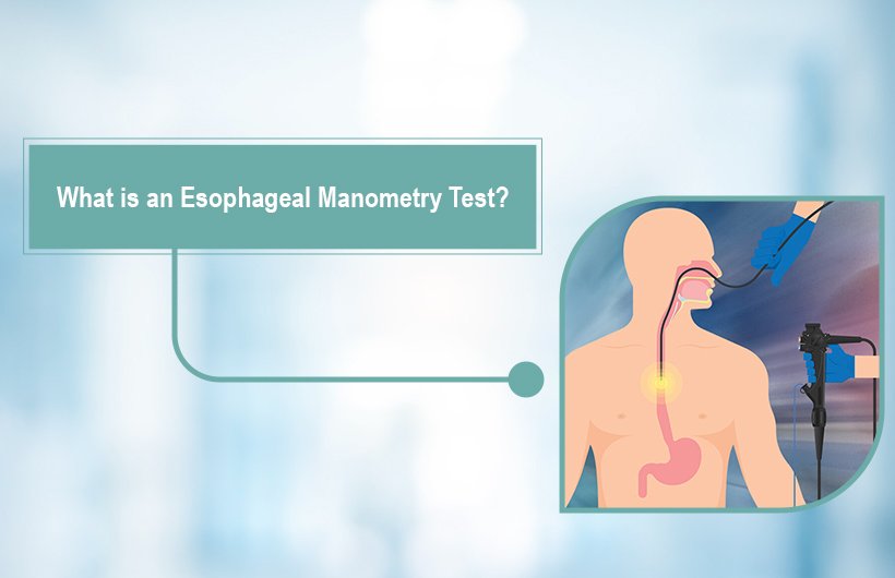 What is an Esophageal Manometry Test? Procedure, Preparation & Results