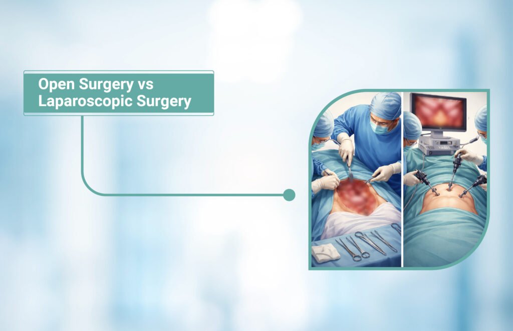 Open Surgery vs Laparoscopic Surgery