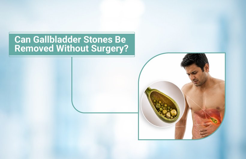 Can Gallbladder Stones Removed Without Surgery?