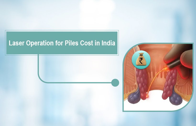 Laser Operation for Piles Cost in India (2026): Treatment, Recovery & Benefits