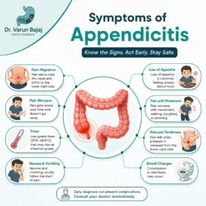 Symptoms of Appendicitis