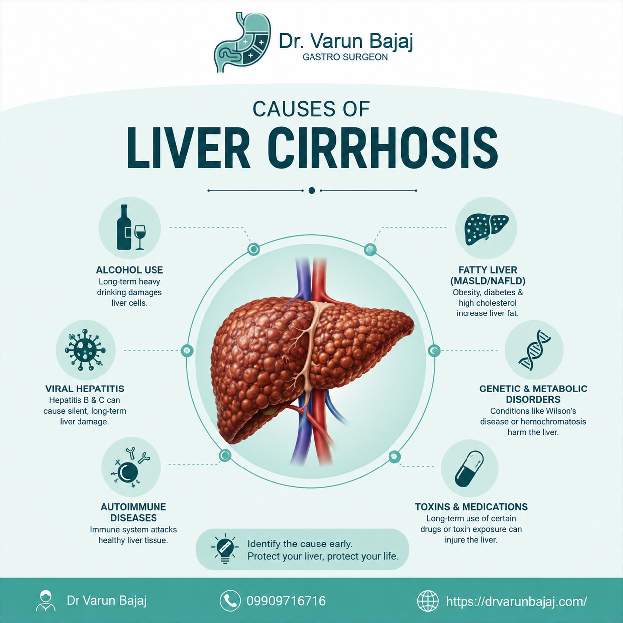 Liver Cirrhosis Treatment in Ahmedabad