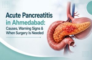 pancreatitis treatment in Ahmedabad